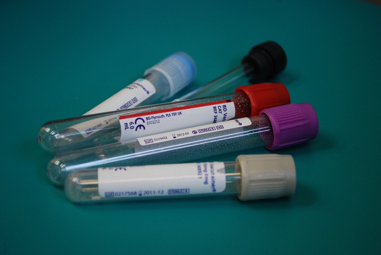 opic diagnostic 신청과 지혜로운 경제 활동 팁